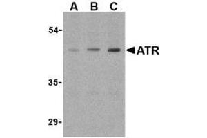 Image no. 2 for anti-anthrax Toxin Receptor 1 (ANTXR1) (Internal Region) antibody (ABIN205769) (ANTXR1 anticorps  (Internal Region))