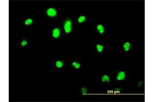Immunofluorescence of monoclonal antibody to GABPA on HeLa cell.