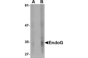 Western Blotting (WB) image for anti-Endonuclease G (ENDOG) (AA 51-140) antibody (ABIN492524) (Endonuclease G anticorps  (AA 51-140))