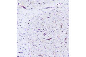 IHC analysis of INPPL1 using anti-INPPL1 antibody (ABIN6719492).