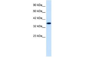 WB Suggested Anti-ZNF75 Antibody Titration:  1. (ZNF75 anticorps  (Middle Region))