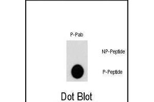 Dot blot analysis of Phospho-AKT2- polyclonal antibody (ABIN389734 and ABIN2839673) on nitrocellulose membrane. (AKT2 anticorps  (pSer474))