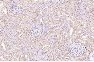Immunohistochemistry analysis of paraffin-embedded rat kidney using,CTSV (ABIN7073348) at dilution of 1: 2000 (Cathepsin L2 anticorps)