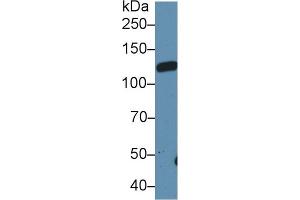 Detection of LIFR in Rat Serum using Polyclonal Antibody to Leukemia Inhibitory Factor Receptor (LIFR)