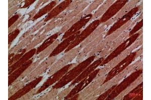 Immunohistochemical analysis of paraffin-embedded Human-skeletal-muscle, antibody was diluted at 1:100 (MYH6 anticorps)