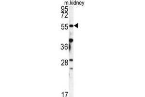 Western Blotting (WB) image for anti-FK506 Binding Protein 9, 63 KDa (FKBP9) antibody (ABIN3003182) (FKBP9 anticorps)