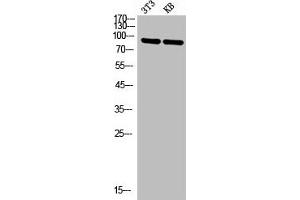 Western Blot analysis of NIH-3T3 KB cells using P-Selectin Polyclonal Antibody (P-Selectin anticorps  (N-Term))
