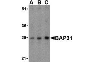 Western Blotting (WB) image for anti-B-Cell Receptor-Associated Protein 31 (BCAP31) (Middle Region) antibody (ABIN1030882) (BCAP31 anticorps  (Middle Region))