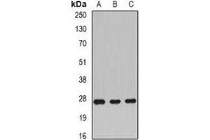 Western blot analysis of Rac 1 expression in BT474 (A), mouse liver (B), rat brain (C) whole cell lysates.