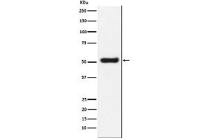 Western blot analysis of OLFM4 expression in LnCaP cell lysate.