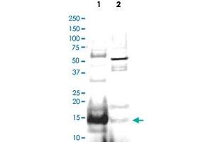 Western blot using UBE2N polyclonal antibody  shows detection of UBE2N protein inhuman small intestine lysate (Lane 1), but not in mouse thymus lysate (Lane 2). (UBE2N anticorps  (AA 40-51))