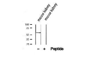 Western blot analysis of extracts from mouse kidney, using SLC13A2 antibody. (SLC13A2 anticorps)