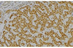 ABIN6276571 at 1/100 staining Mouse liver tissue by IHC-P. (GAS2 anticorps  (C-Term))