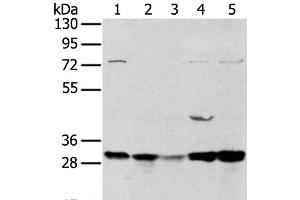 Western Blot analysis of 293T and MCF7 cell, Mouse brain tissue and K562 cell, Mouse bladder tissue using TPD54 Polyclonal Antibody at dilution of 1:400 (TPD52L2 anticorps)