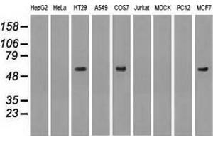 Western blot analysis of extracts (35 µg) from 9 different cell lines by using anti-anti-NRBP1monoclonal antibody. (NRBP1 anticorps)