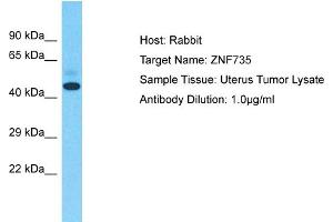 Host: Rabbit Target Name: ZNF735 Sample Type: Uterus Tumor lysates Antibody Dilution: 1. (Zinc Finger Protein 735 (ZNF735) (Middle Region) anticorps)