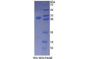 SDS-PAGE analysis of Human RXRg Protein. (Retinoid X Receptor gamma Protéine)