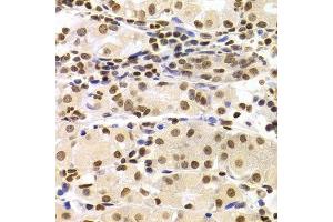 Immunohistochemistry of paraffin-embedded human stomach using HMGB1 Antibody. (HMGB1 anticorps  (AA 100-200))
