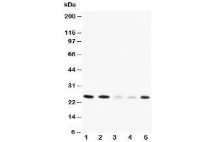 Western blot testing of Pleiotrophin antibody and Lane 1:  rat brain (Pleiotrophin anticorps  (C-Term))
