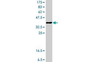 Western Blot detection against Immunogen (37.