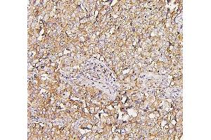 IHC analysis of NMI using anti-NMI antibody (ABIN6719489).