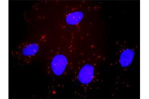 Proximity Ligation Analysis of protein-protein interactions between BID and BAX.