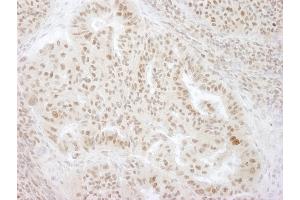 Immunohistochemistry (IHC) image for anti-Kinesin Family Member C1 (KIFC1) (AA 625-673) antibody (ABIN7448624) (KIFC1 anticorps  (AA 625-673))