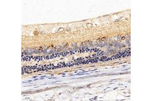 Immunohistochemistry of paraffin embedded rat eye using C1QL2 (ABIN7073561) at dilution of 1: 1000 (400x lens) (C1QL2 anticorps)