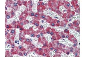 Human Liver: Formalin-Fixed, Paraffin-Embedded (FFPE) (PAR1 anticorps  (Internal Region))