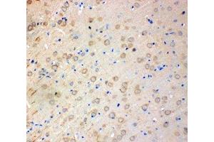 IHC-P: SOD2 antibody testing of rat brain tissue (SOD2 anticorps  (N-Term))