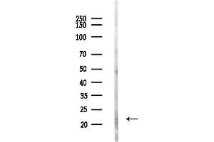 Western blot analysis of lysates from COLO205 cells(UV,30 min treatment), using BASP1 Antibody at 1/1000 dilution.