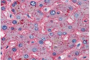 Human Liver (formalin-fixed, paraffin-embedded) stained with APOB antibody ABIN337314 at 5 ug/ml followed by biotinylated anti-goat IgG secondary antibody ABIN481715, alkaline phosphatase-streptavidin and chromogen. (APOB anticorps)