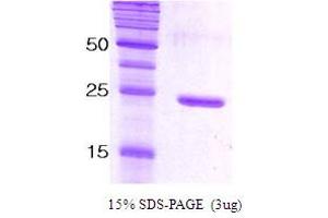 SDS-PAGE (SDS) image for Synaptosomal-Associated Protein, 25kDa (SNAP25) protein (ABIN666820)