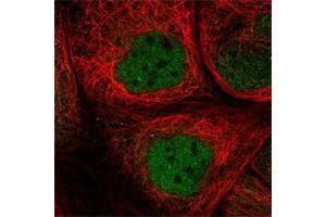 Immunofluorescent staining of human cell line A-431 shows positivity in nucleus but not nucleoli. (SMCR8 anticorps)