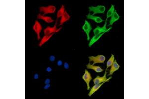ABIN7095475 and ABIN7099532 staining Hela cells by IF/ICC. (TPD52 anticorps)