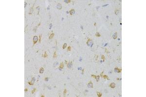 Immunohistochemistry of paraffin-embedded mouse brain using KISS1R Antibody (ABIN3017091, ABIN3017092, ABIN3017093 and ABIN6219946) at dilution of 1:100 (40x lens). (KISS1R anticorps)