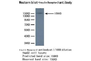 Western Blotting (WB) image for anti-Insulin Receptor beta (ISR-beta) antibody (ABIN1873245) (ISR-beta anticorps)