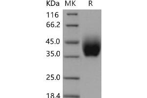 Western Blotting (WB) image for Interleukin 10 Receptor, beta (IL10RB) (Active) protein (His tag) (ABIN7320127)
