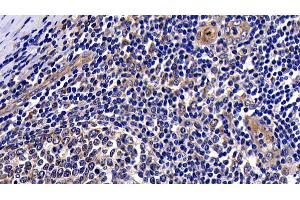 anti-V-Akt Murine Thymoma Viral Oncogene Homolog 1 (AKT1) (AA 122-443) antibody