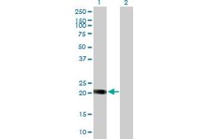 Western Blot analysis of NOP16 expression in transfected 293T cell line by NOP16 MaxPab polyclonal antibody.