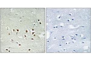 Immunohistochemistry analysis of paraffin-embedded human brain, using MAPKAPK2 (Phospho-Thr334) Antibody.