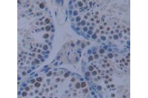 Used in DAB staining on fromalin fixed paraffin- embedded testis tissue (CSRP1 anticorps  (AA 1-193))