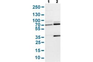 Western Blot analysis with SENP1 polyclonal antibody . (SENP1 anticorps  (AA 85-204))