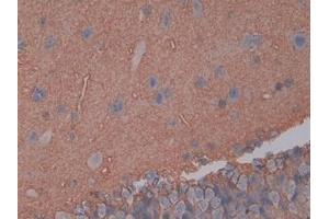 Detection of AQP4 in Rat Cerebrum Tissue using Polyclonal Antibody to Aquaporin 4 (AQP4)