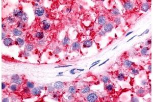 Anti-LRH-1 / NR5A2 antibody IHC staining of human testis.