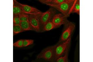 IF analysis of RbAp48 using anti-RbAp48 antibody (ABIN3043920) and anti-Beta Tubulin antibody (ABIN7602743). (Retinoblastoma Binding Protein 4 anticorps  (C-Term))