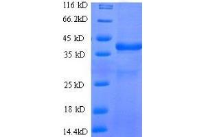 WAP Four-Disulfide Core Domain 2 (WFDC2) (AA 31-124), (full length) protein (GST tag)