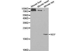 Western blot analysis of extracts of various cell lines, using NDP antibody. (Norrie Disease (Pseudoglioma) anticorps  (AA 25-133))