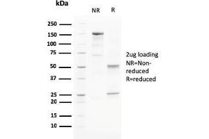 SDS-PAGE Analysis Purified PAPP-A Mouse Monoclonal Antibody (PAPPA/2715). (PAPPA anticorps  (AA 351-523))