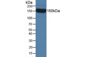 Detection of SEMA5B in Mouse Serum using Polyclonal Antibody to Semaphorin 5B (SEMA5B)